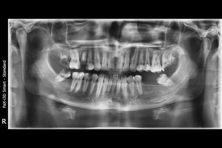 Las huellas de la ocupación rusa